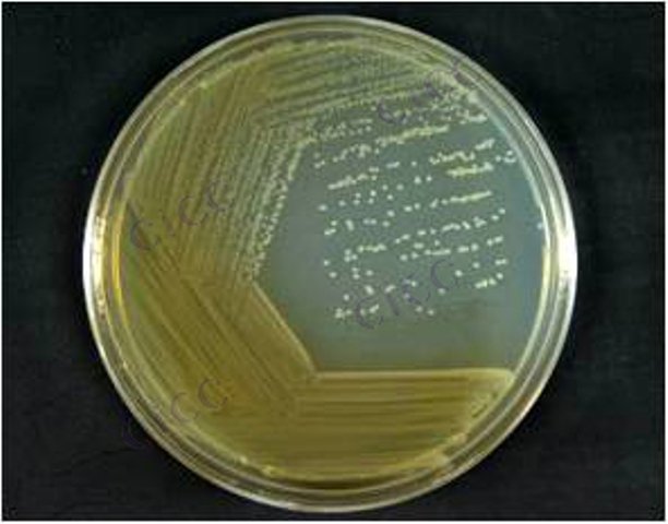 Acinetobacter parvus