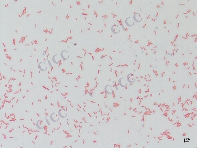 Citrobacter freundii