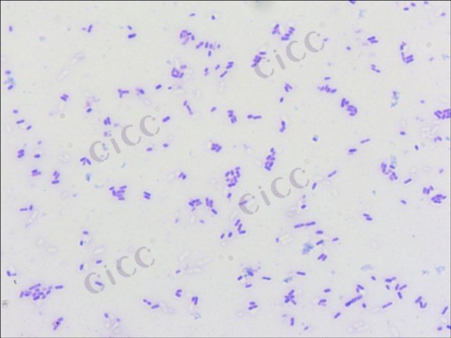 Salmonella enterica subsp enterica serovar Typhimurium