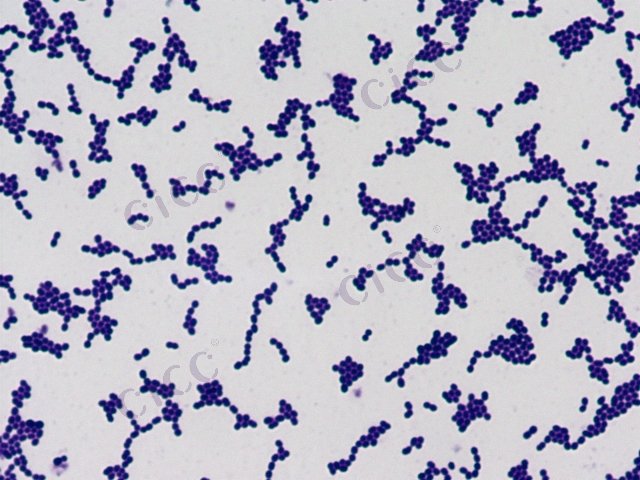 Enterococcus faecium