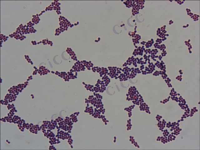Lactococcus lactis subsp lactis