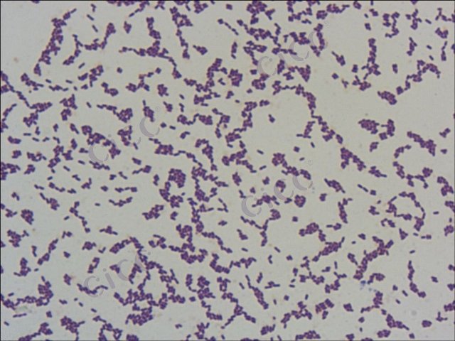 Listeria monocytogenes