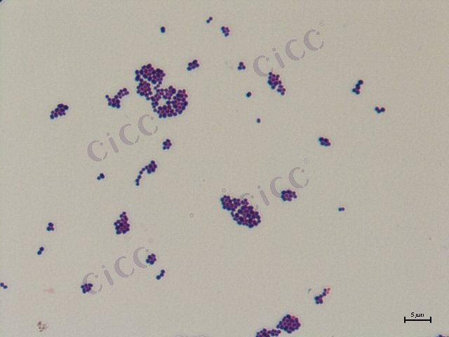 Enterococcus faecium