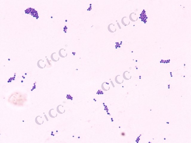 Staphylococcus saprophyticus