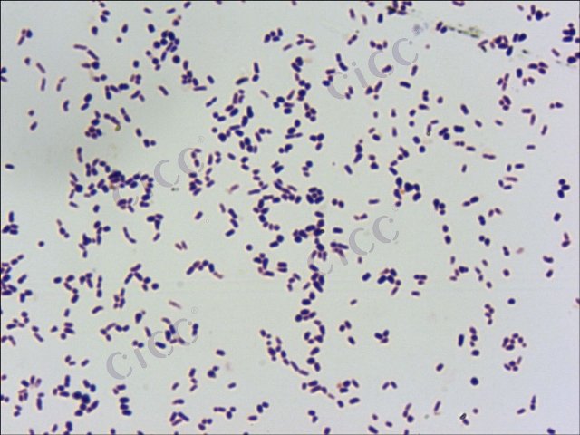 Rhodococcus ruber