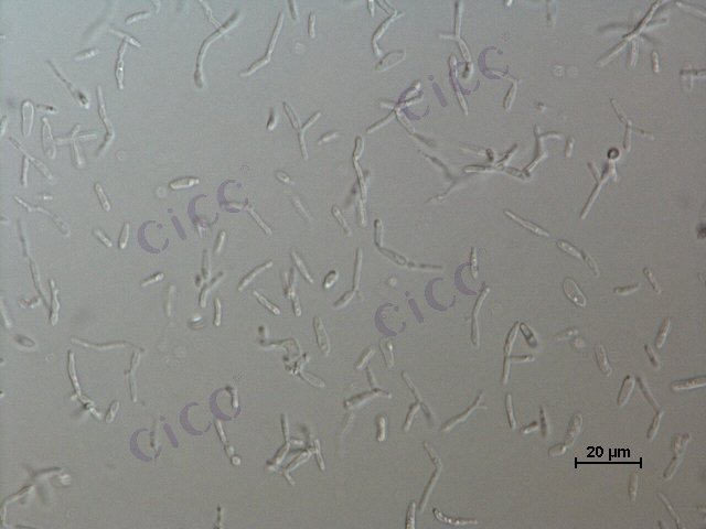 Rhodotorula mucilaginosa