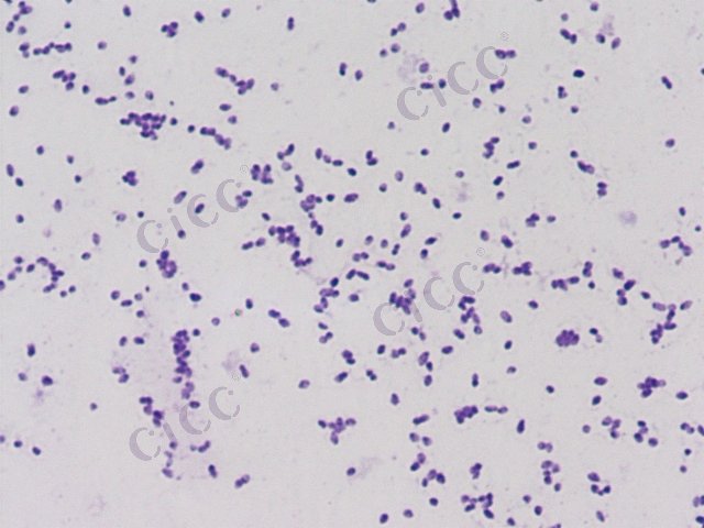 Syntrophococcus luzhoulaojiao