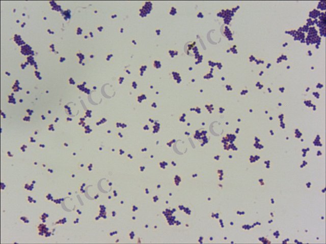 金黄色葡萄球菌 Staphylococcus aureus  CICC 10473 Staphylococcus aureus