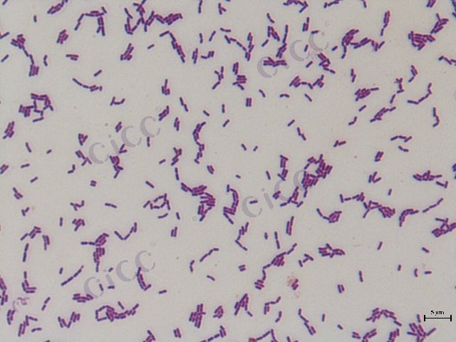 Lacticaseibacillus rhamnosus