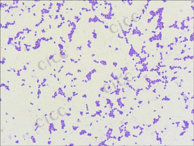 Citrobacter freundii