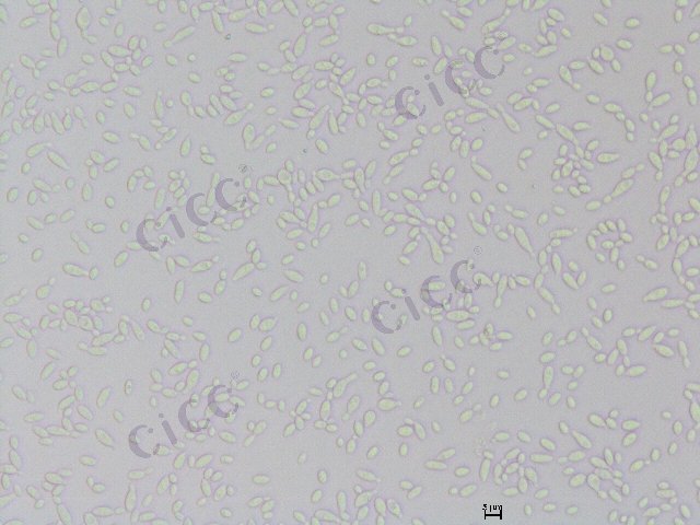 Sympodiomycopsis yantaiensis