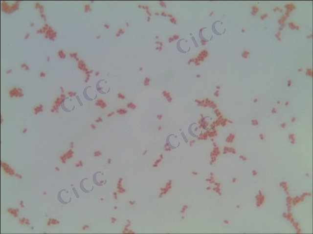 Salmonella enterica subsp enterica serotype Eastbourne