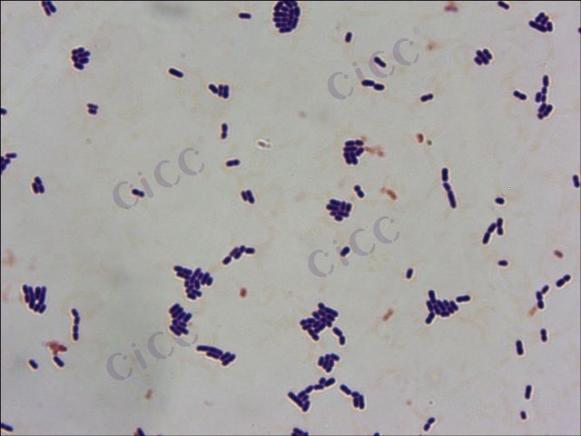 Lactiplantibacillus plantarum