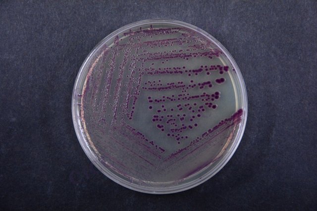 副溶血弧菌 Vibrio parahaemolyticus CICC 21617 Vibrio parahaemolyticus
