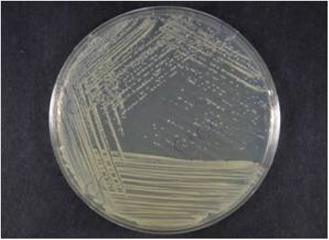 Rhizobium larrymoorei