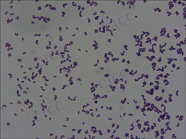 Corynebacterium glutamicum