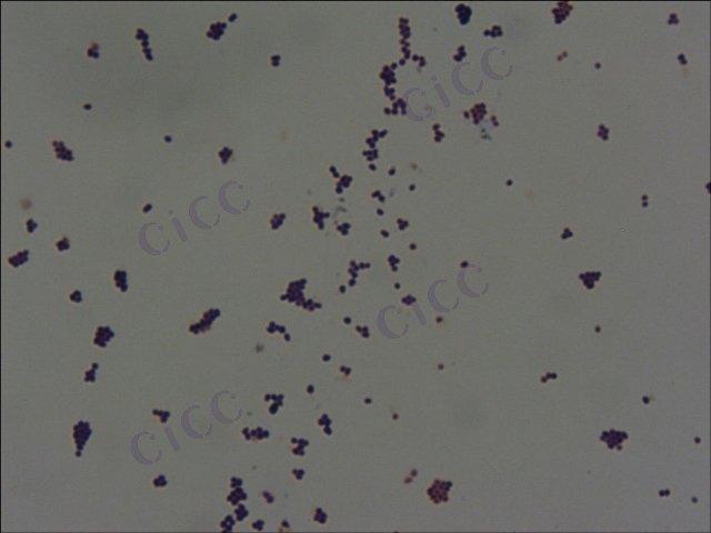 Arthrobacter sp