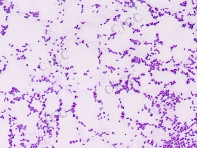 Cronobacter sakazakii