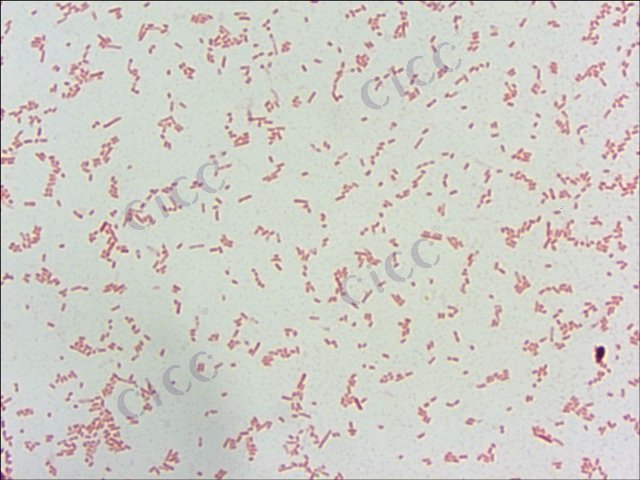 Yersinia enterocolitica