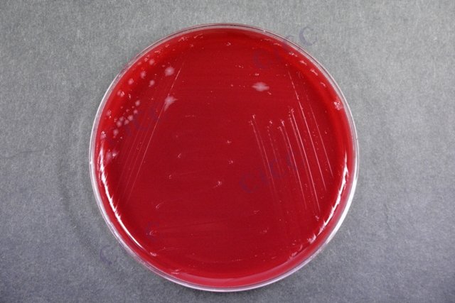 艰难梭菌 Clostridium difficile CICC 22951 Clostridium difficile