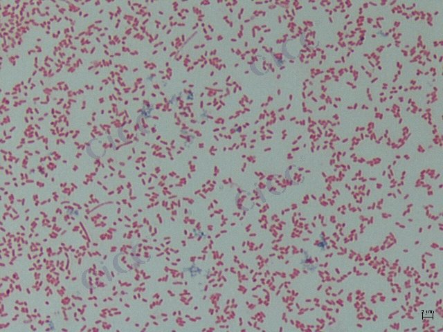 Vibrio alginolyticus