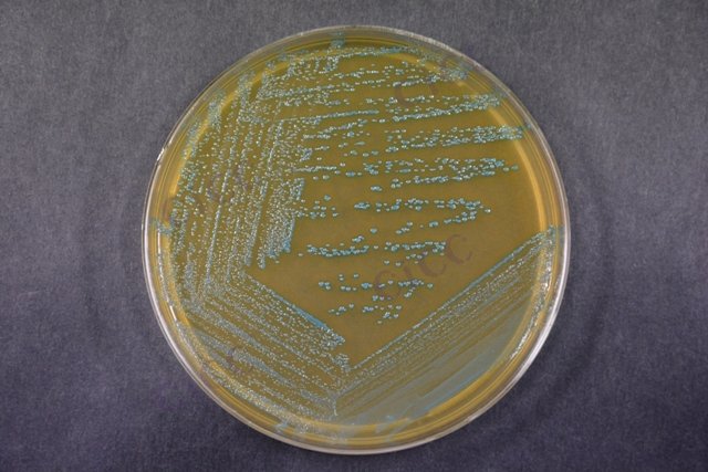 单核增生李斯特氏菌 Listeria monocytogenes CICC 21633 Listeria monocytogenes