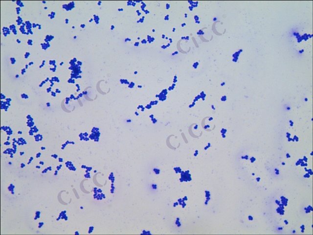 Corynebacterium ammoniagenes