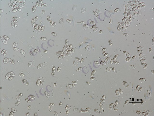 Saccharomyces cerevisiae