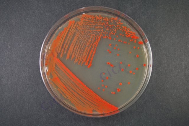 Gordonia alkanivorans