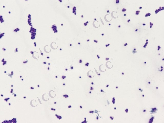 Klebsiella oxytoca