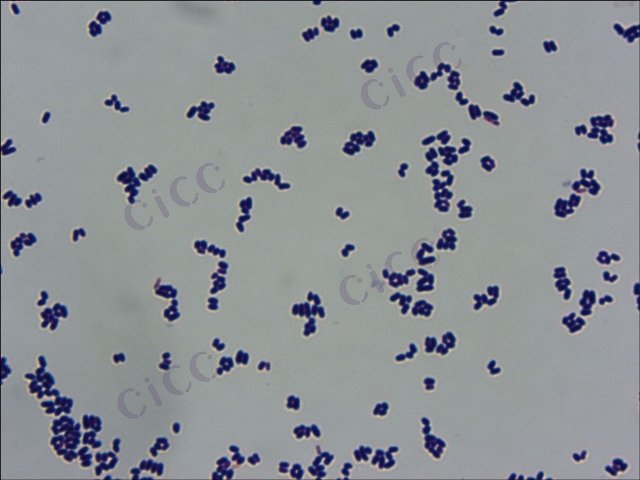 Corynebacterium glutamicum