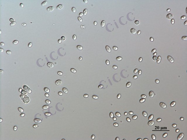 Saccharomyces cerevisiae