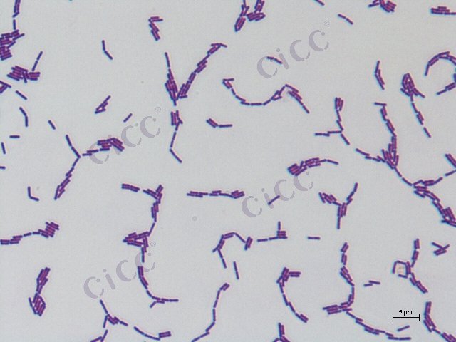 Lacticaseibacillus rhamnosus