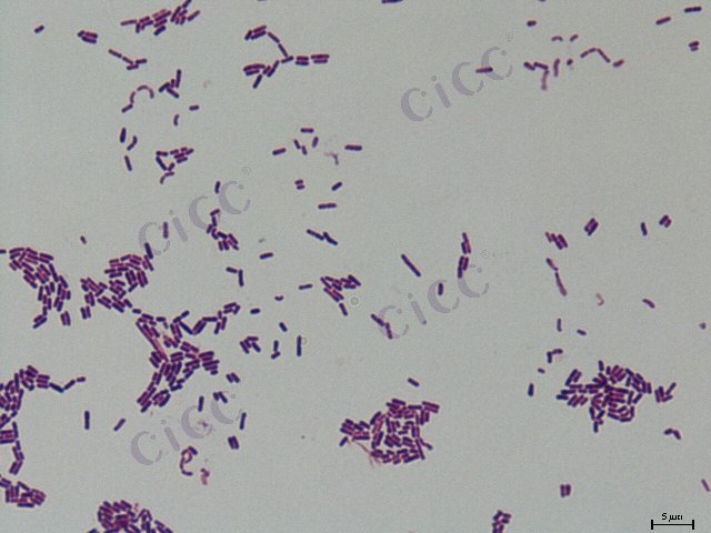 Lacticaseibacillus paracasei subsp paracasei
