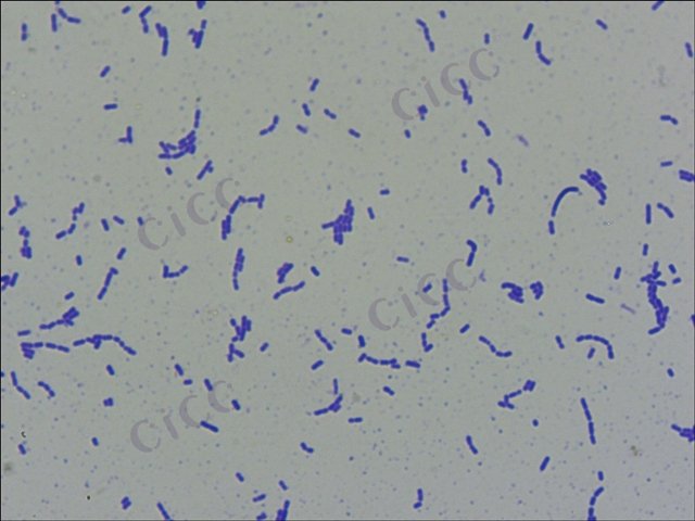 Lacticaseibacillus paracasei subsp tolerans