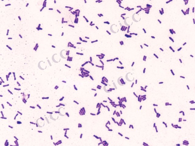 Bifidobacterium animalis subsp lactis