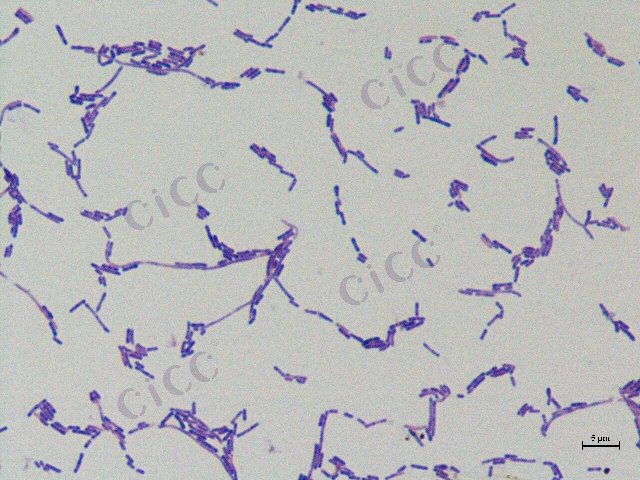 Lacticaseibacillus paracasei subsp paracasei