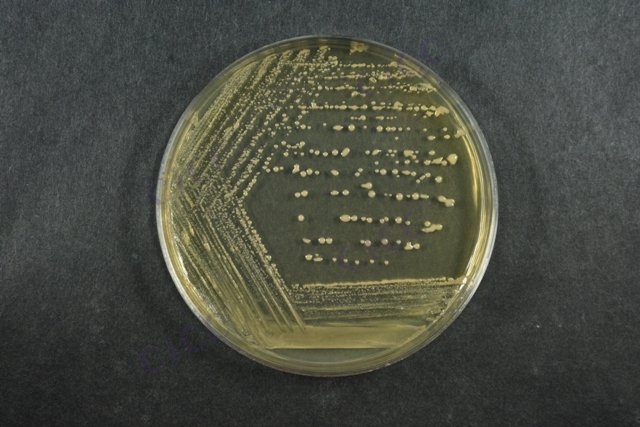 马红球菌 Rhodococcus equi CICC 22955 Rhodococcus equi