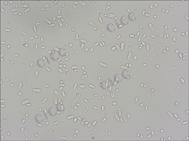 Rhodosporidium toruloides