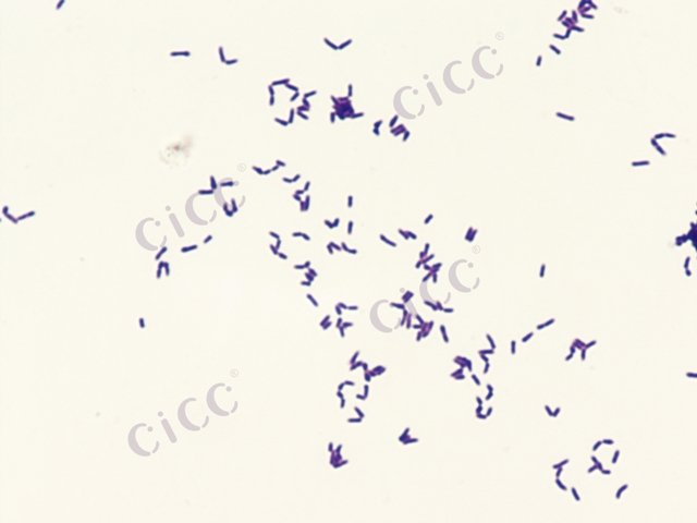 Gordonia hydrophobica