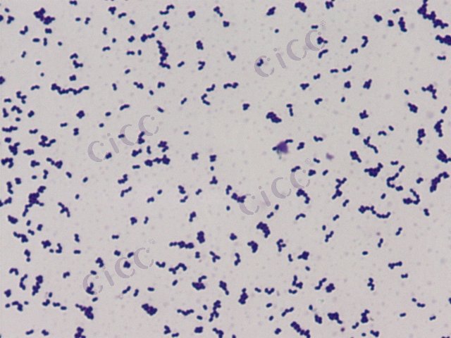 Brachybacterium squillarum