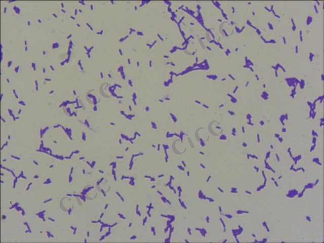 Listeria monocytogenes