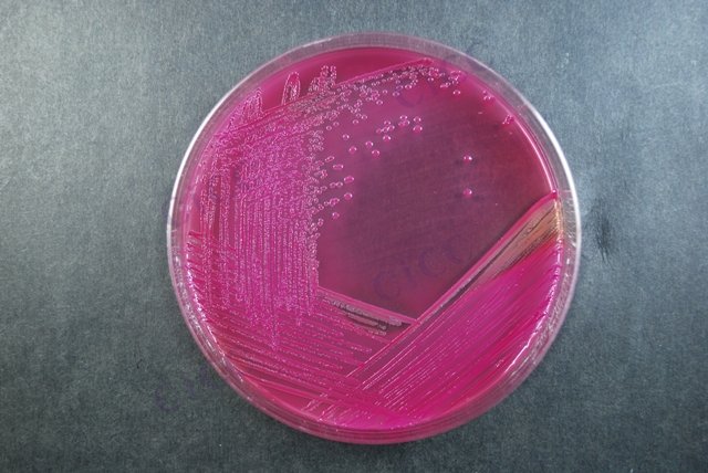 小肠结肠炎耶尔森氏菌 Yersinia enterocolitica CICC 21669 Yersinia enterocolitica