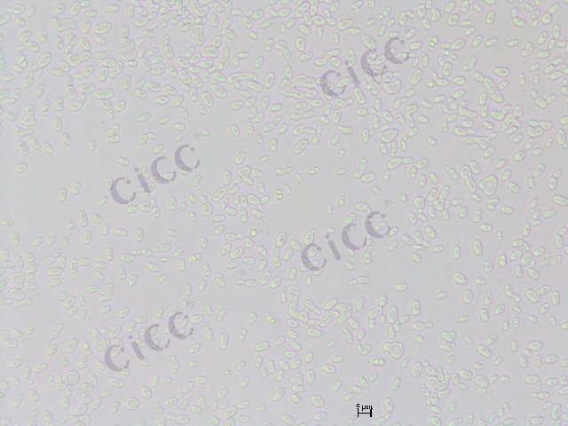 Tetrapisispora iriomotensis