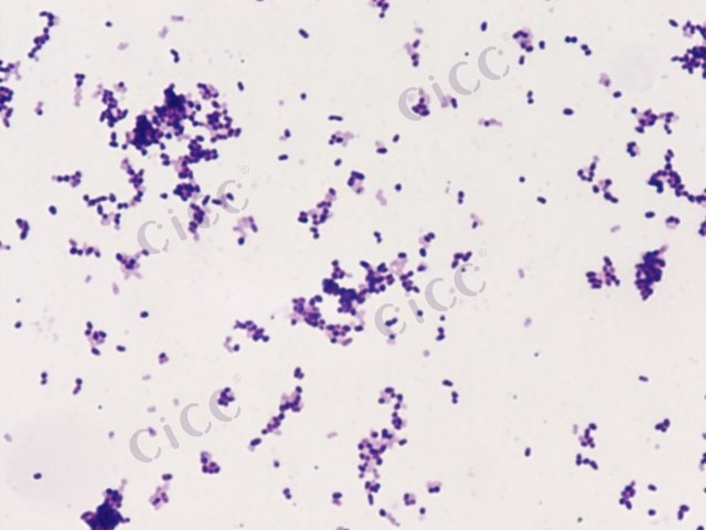 Gordonia neofelifaecis