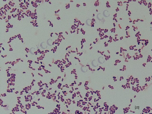 Deinococcus arcticus