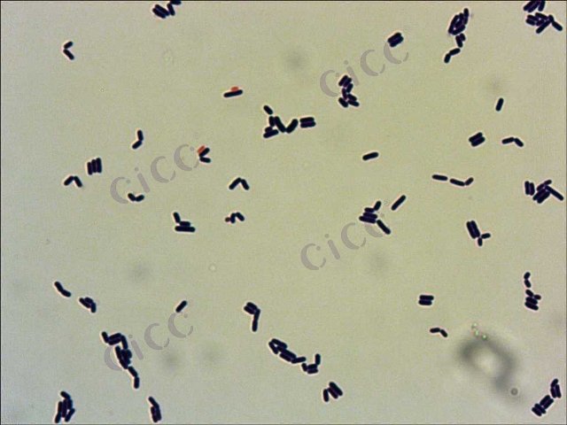 Lactiplantibacillus plantarum