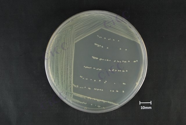 Klebsiella oxytoca