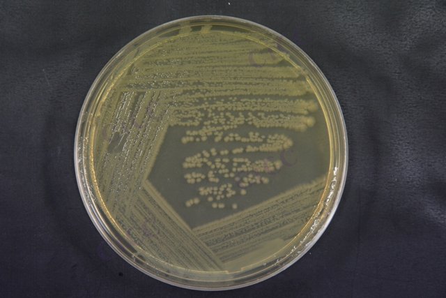 产肠毒素大肠埃希氏菌 Escherichia coli ETEC CICC 24190 Escherichia coli ETEC