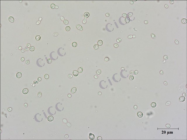 Saccharomyces cerevisiae